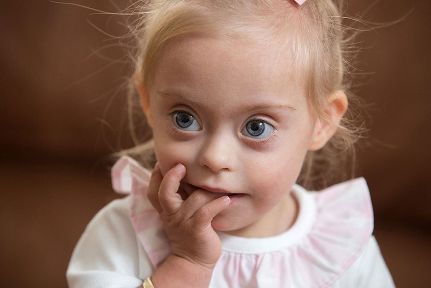 2-летняя девочка с синдромом Дауна выиграла контракт с модельным агентством 