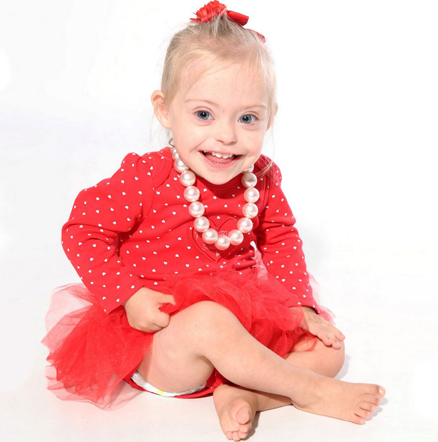 2-летняя девочка с синдромом Дауна выиграла контракт с модельным агентством 