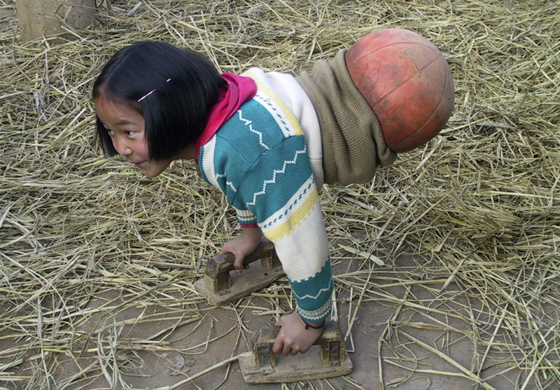 Добра пост: История девочки с баскетбольным мячиком