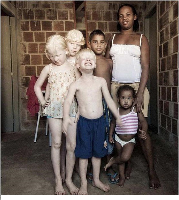 1. Уникальные альбиносы необычное, семьи, факты
