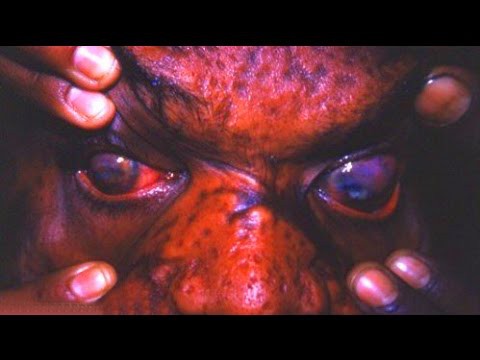 Самые страшные болезни-убийцы человечества 
