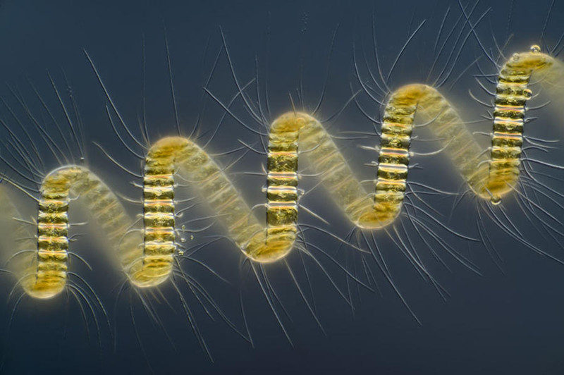 34. Колониальный организм планктона — Chaetoceros debilis