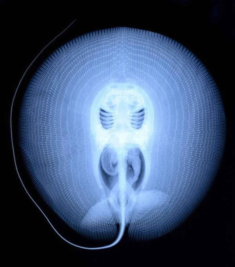 Рентгеновский снимок ската.