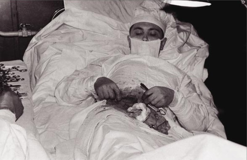 6. 1961 — Хирург Леонид Рогозов успешно выполнил на себе операцию аппендэктомии.