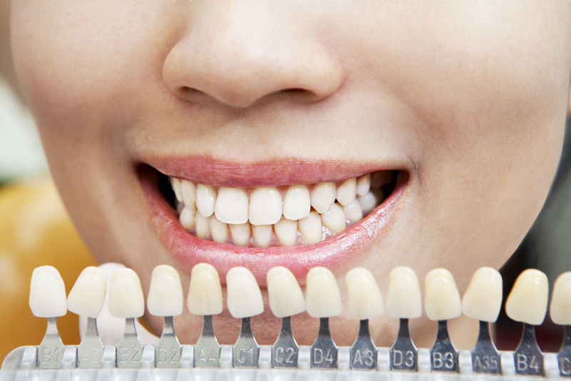Отбеливающие зубные пасты устраняют желтый оттенок