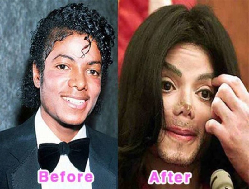 До и после пластических операций