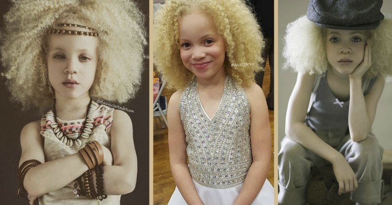 8-летняя девочка-альбинос делает карьеру в модельном бизнесе