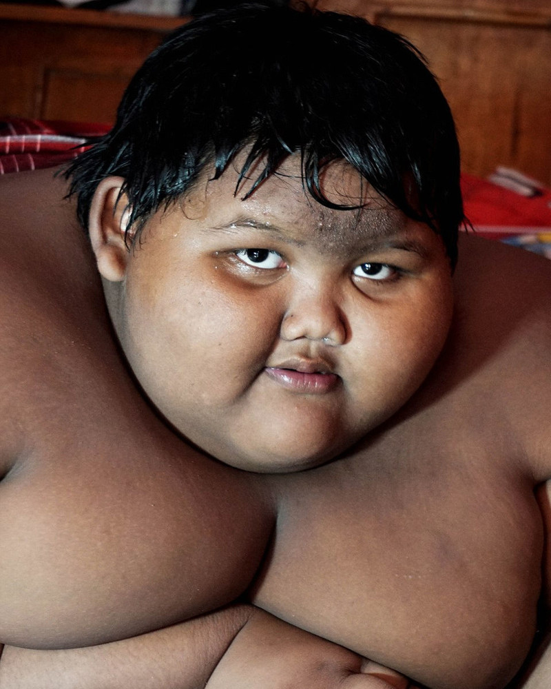 Самый толстый мальчик в мире: 192 кг в 10-летнем возрасте