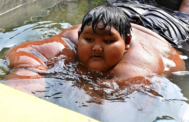 Самый толстый мальчик в мире: 192 кг в 10-летнем возрасте
