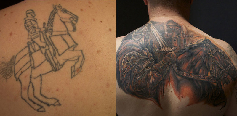 Существующие способы удаления татуировок и их особенности