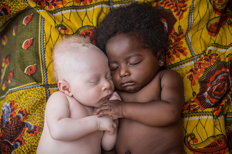 Темнокожий младенец держит малыша-альбиноса во сне.