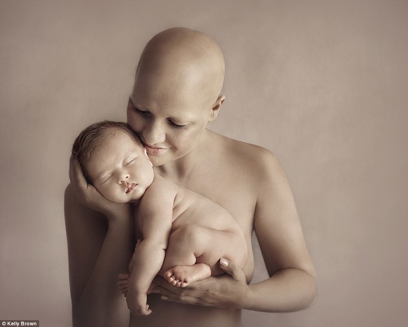 Австралийские фотографы воплотили чудо материнской любви