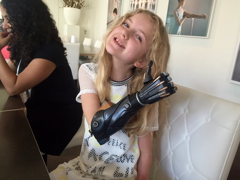 Девочка с бионической рукой