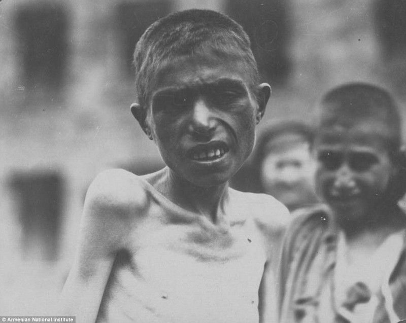 Армянский мальчик, 1915 год