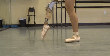 Юная балерина танцует, несмотря на ампутированную ногу