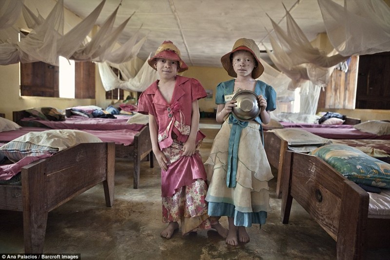 Деревня проклятых: в Танзании создали убежище для альбиносов