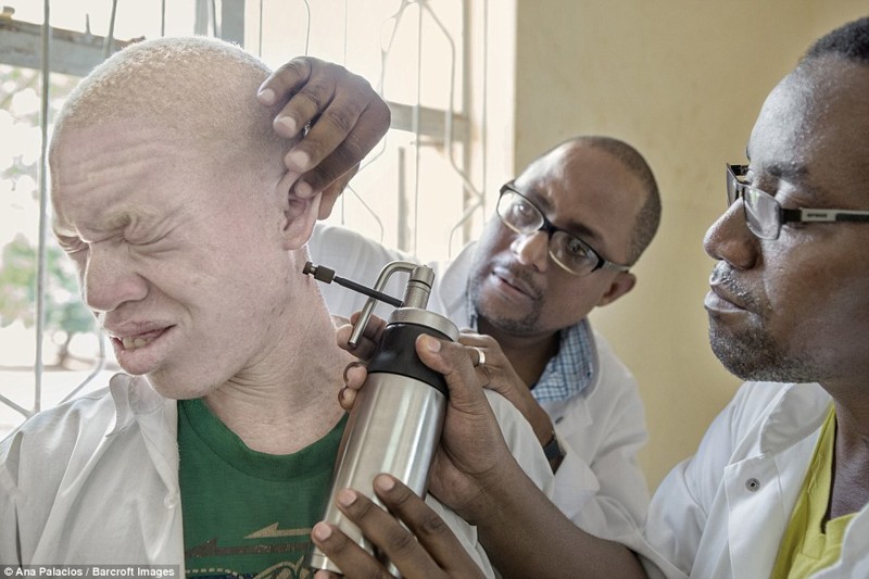 Деревня проклятых: в Танзании создали убежище для альбиносов