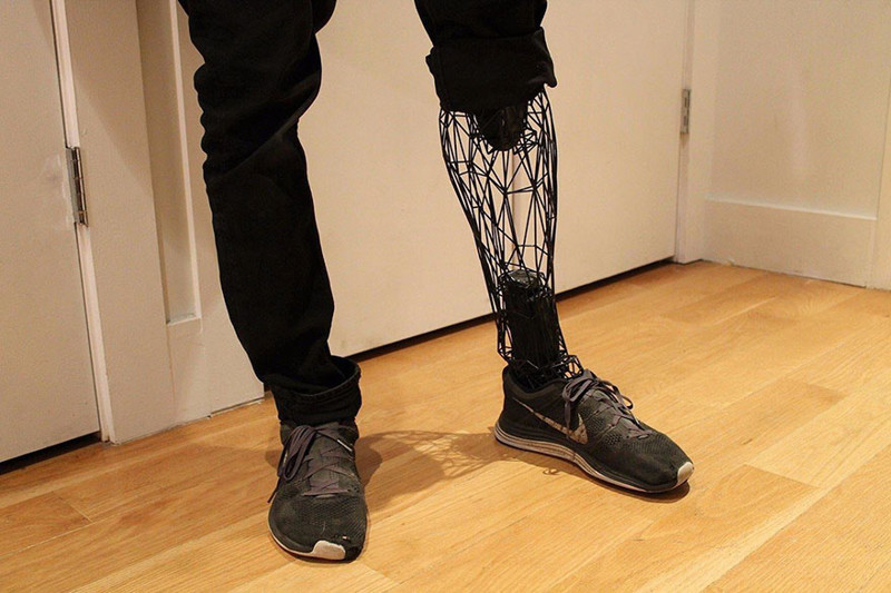 Каркасный протез из титана, распечатанный на 3D-принтере, может совершить революцию в цене протезов
