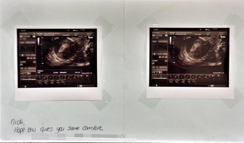 Женщина, которая сделала аборт, получила из клиники неожиданное послание
