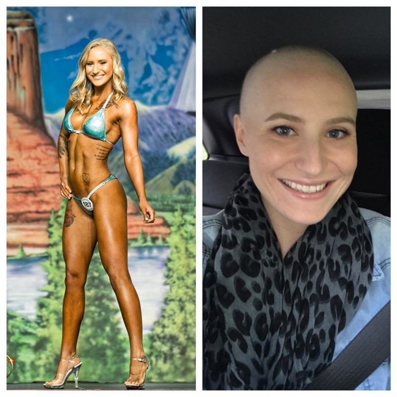 23-летняя культуристка борется с раком — и публикует это в Instagram*
