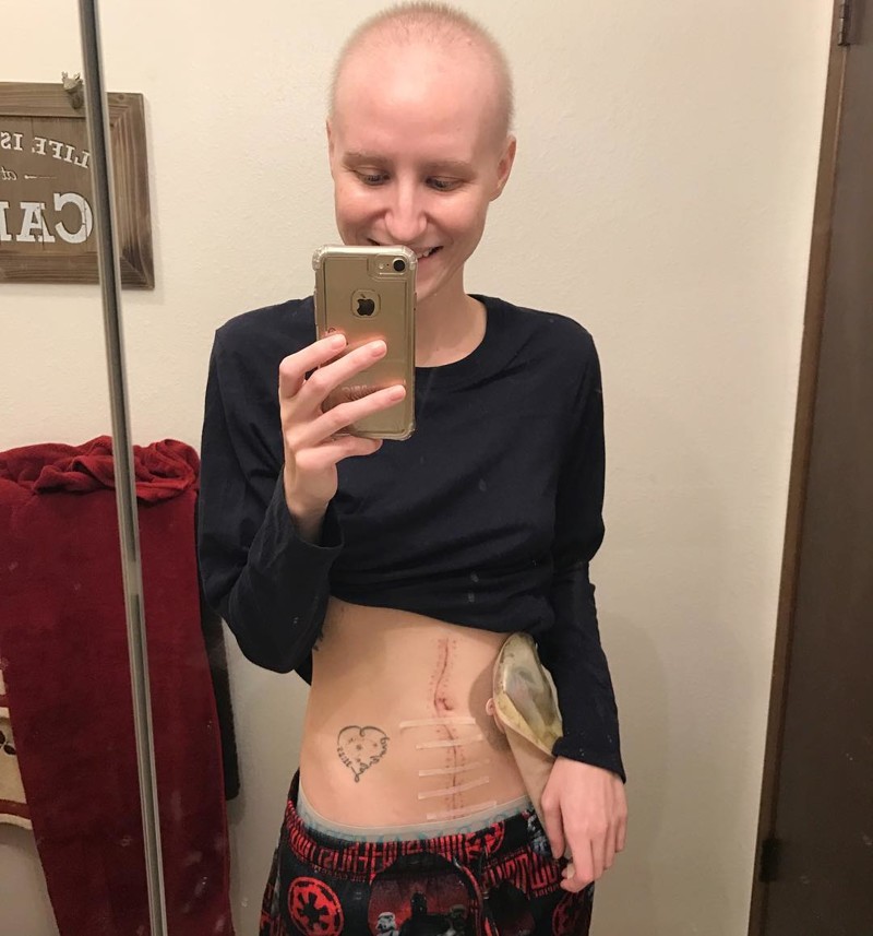 23-летняя культуристка борется с раком — и публикует это в Instagram*