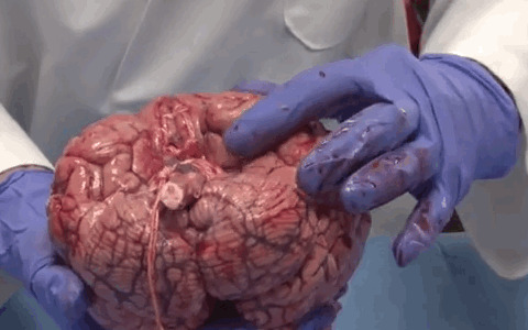 18. Профессор анатомии демонстрирует, насколько нежный человеческий мозг на самом деле