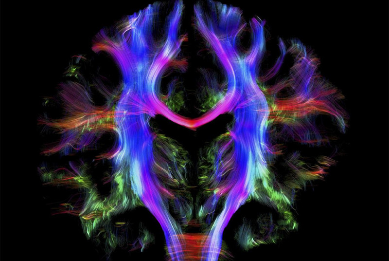«Проводка» головного мозга