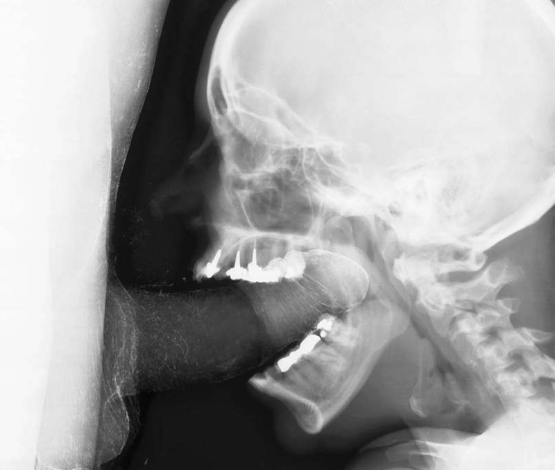 Пикантные секс фото снимки под рентгеном (рентген-анатомия)