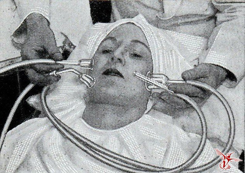 14. Вакуумный массаж лица для гладкости кожи и прекрасного цвета лица. 1930-е. 