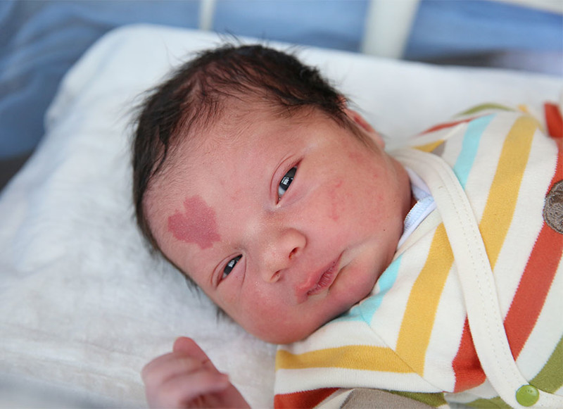Самое сердечное дитя в мире: в Турции родился младенец с сердечком на лице