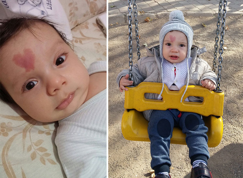 Самое сердечное дитя в мире: в Турции родился младенец с сердечком на лице