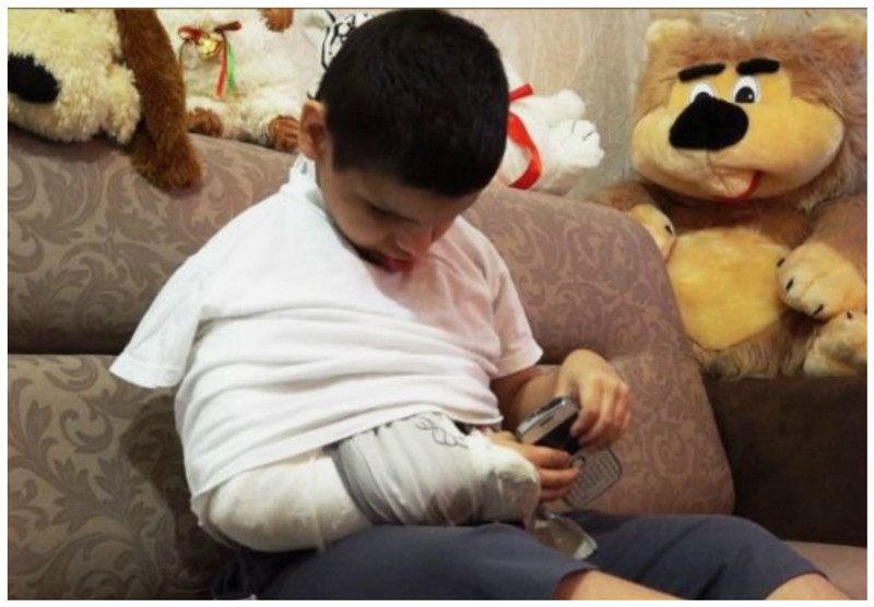 Воспитатель, сломавшая руку слепому мальчику-инвалиду, получила 8 месяцев колонии