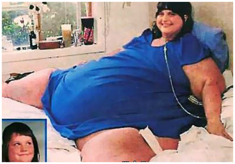 Кэрол Энн Ягер - 544 кг (самая толстая женщина в истории медицины, скончалась в 1994 году)