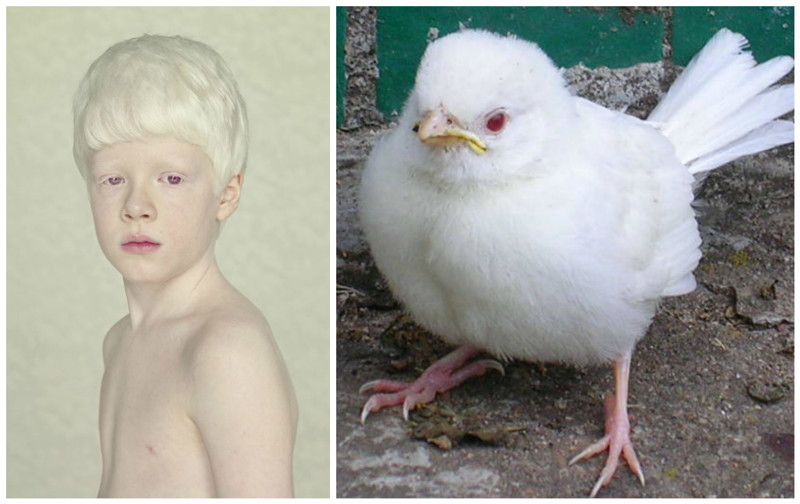 Глазной альбинизм: при нем поражаются только глаза.