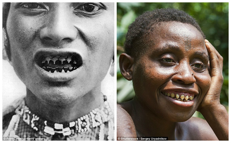 Слева - представитель племени Багобо (Филиппины) показывает заостренные зубы (снимок 1910 года). Справа - женщина племени пигмеев Бака (Центральноафриканская Республика, снимок 2008 года)