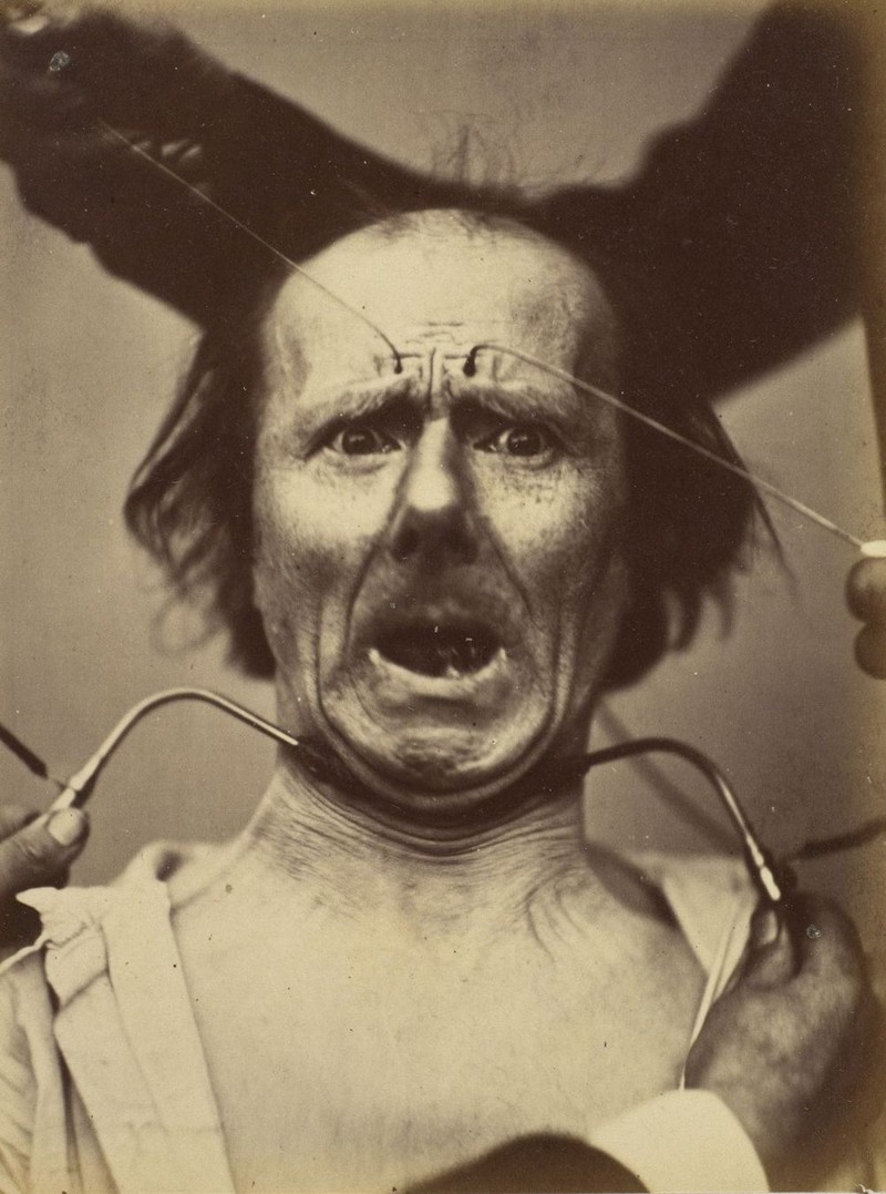 Наука, ты меня пугаешь: как невропатолог Дюшен де Булонь изучал эмоции и мышцы лица в 1862 году