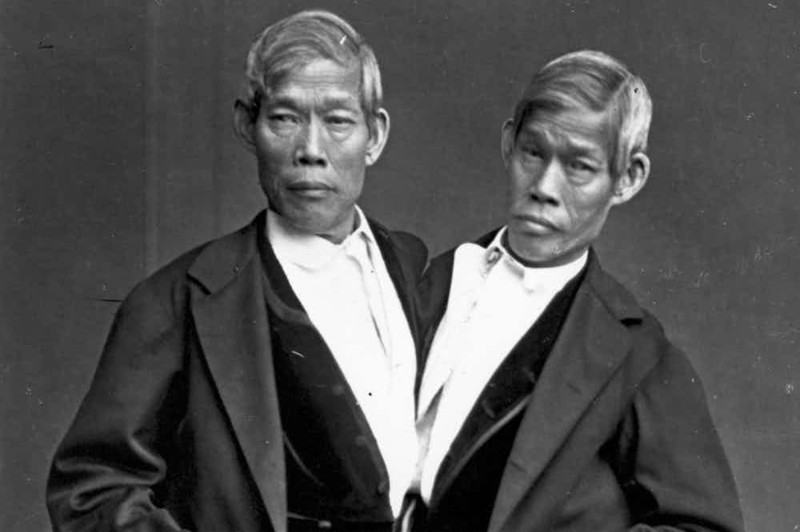 Чанг и Энг - сиамские близнецы