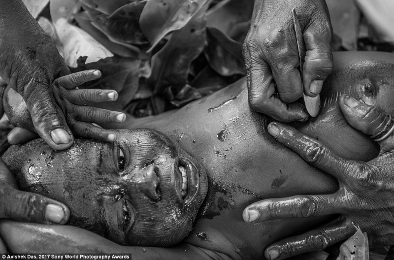 2-летний мальчик во время болезненной церемонии шрамирования, Бенин, Западная Африка