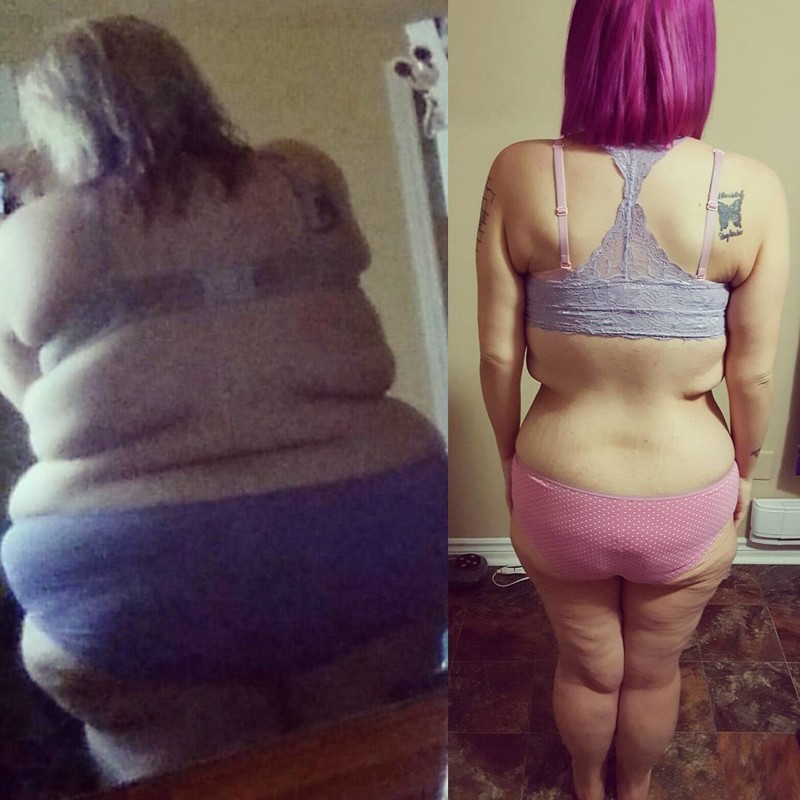 После потери 85 кг эта женщина осталась с огромным количеством лишней кожи, и она не постеснялась её показать 