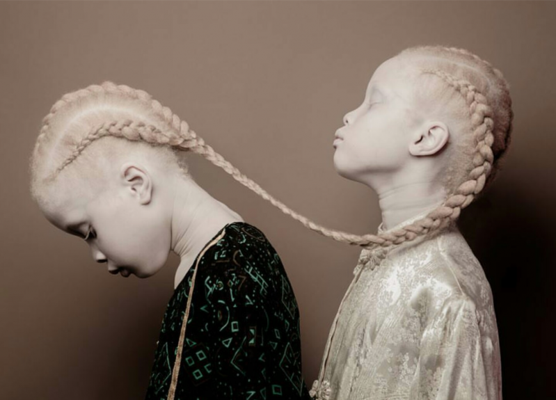 Сестры-альбиносы 