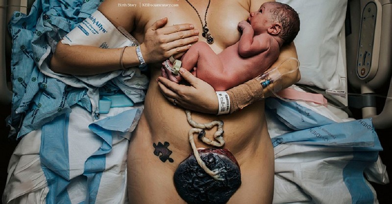 Лучшие в мире снимки, запечатлевшие таинство рождения
