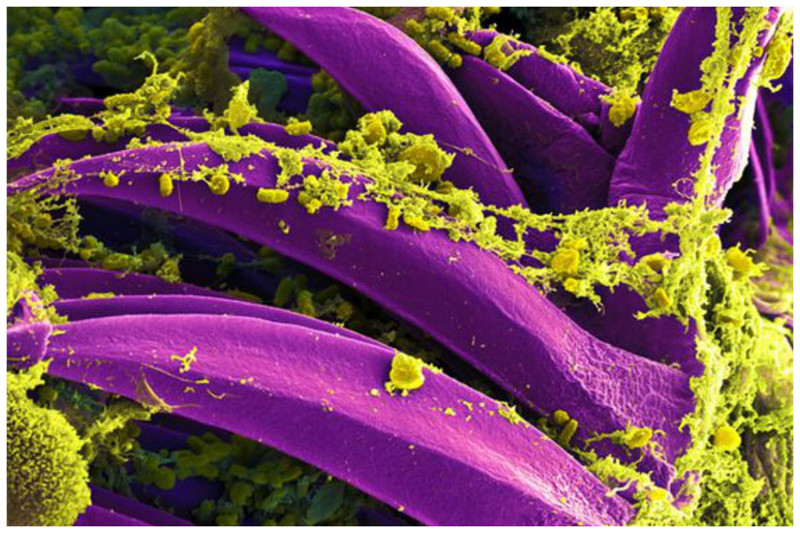 Бактерия бубонной чумы на частях пищеварительной системы крысиной блохи интересное, красота, микросъемка, удивительное