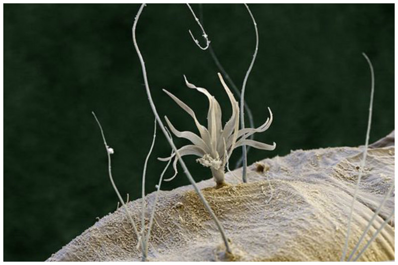 Волосы на теле личинки комара