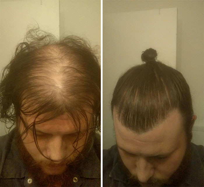 Мой парень наращивает волосы