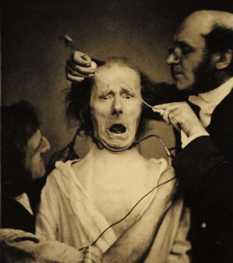 Медицинские эксперименты 19 века