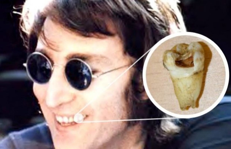 5. Зуб Джона Леннона за 30 тыс долларов купил канадский стоматолог. Символично!