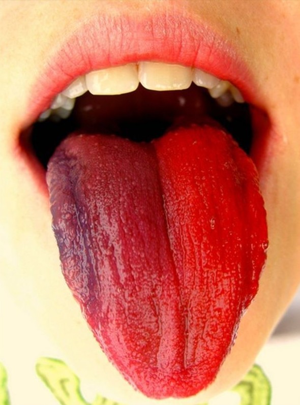 Кроваво-красный язык 