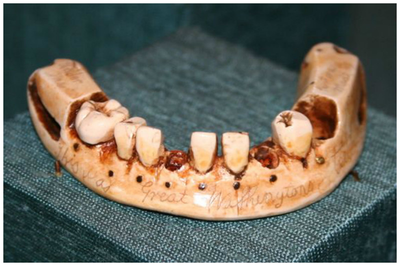 Зубы вырывались у погибших в бою солдат и  продавались для протезирования