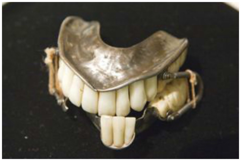 Серебряные протезы, прикрепленные букальными проволочными пружинами, около 1829 года. В этом полном верхнем и частично нижнем протезе передние зубы изготовлены из фарфора, а задние моляры вырезаны из слоновой кости.