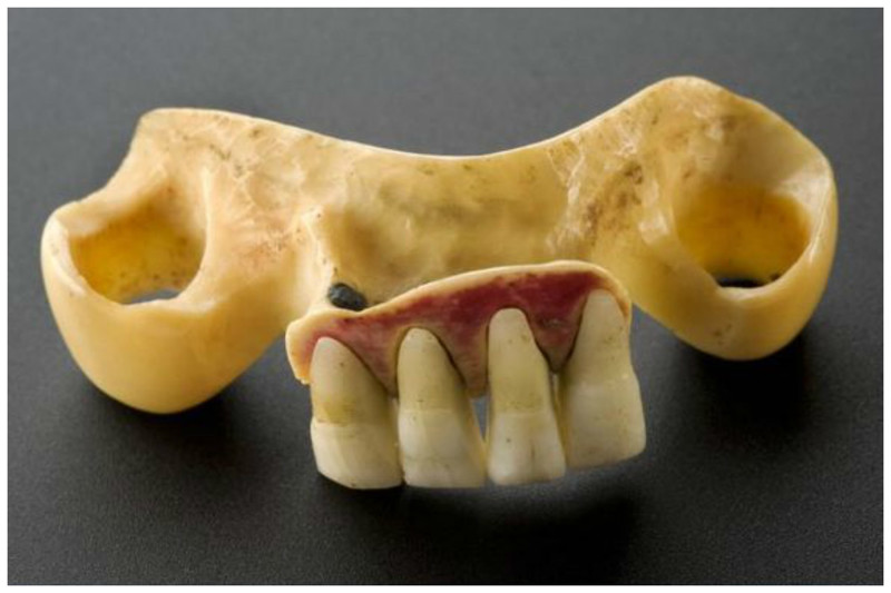 Такие зубы назывались "Зубы Ватерлоо" - поставки с полей сражений не прекращались. Эта челюсть сделала из кости бегемота плюс зубы Ватерлоо